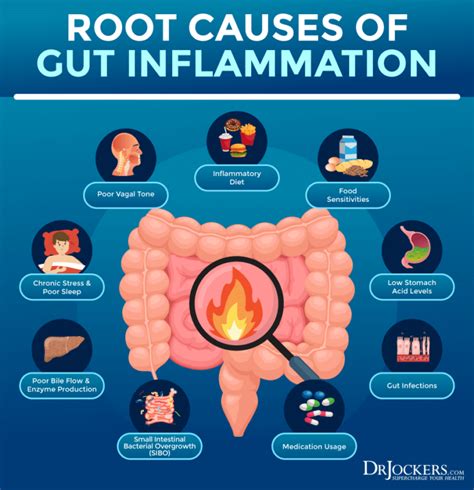 estomac inflamat|inflammation of the gut.